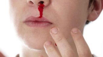 Mơ thấy người khác chảy máu đánh con gì, số mấy, điềm báo gì, tốt hay xấu?