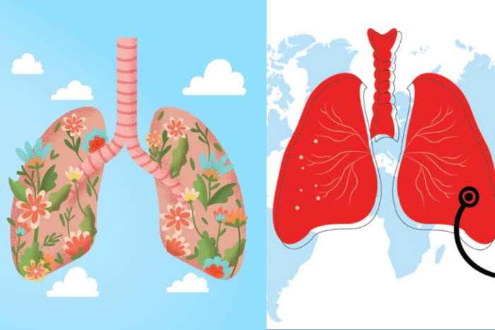 24/3 là ngày gì - Ngày quốc tế Phòng chống Lao