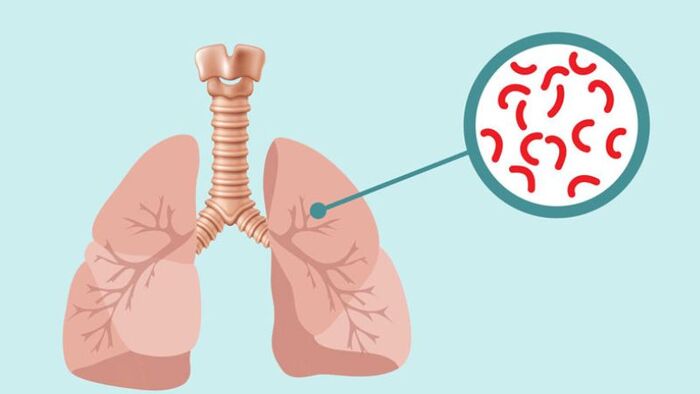 Ở Việt Nam 24/3 là ngày gì?