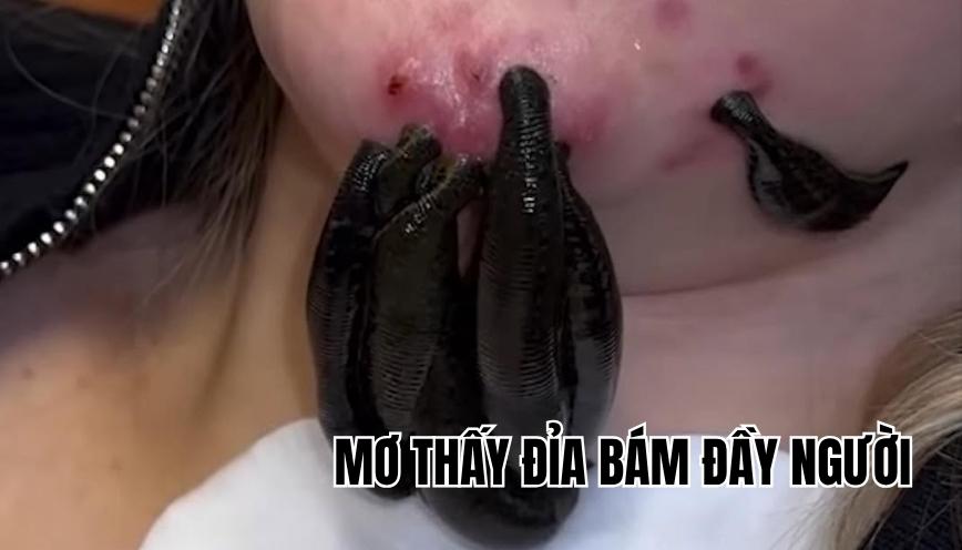 mơ thấy đỉa bám đầy người